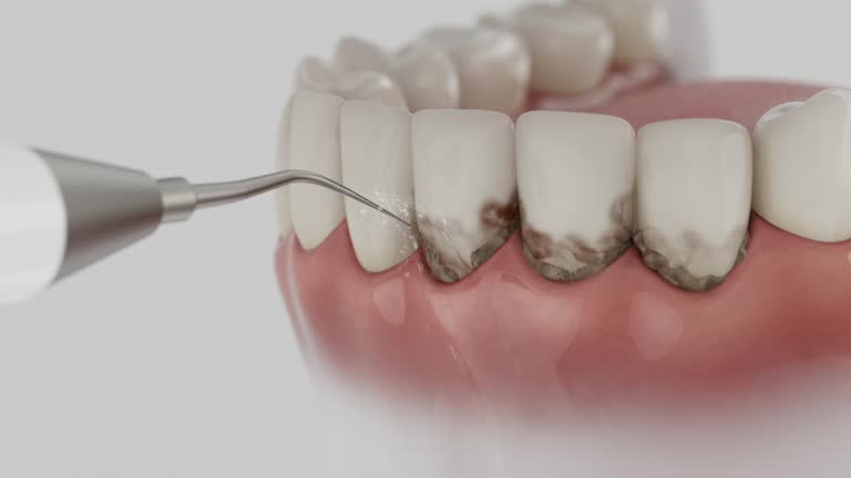 Reliable Dental Implants contractor in Lyons, WI by Smile Center Dentistry